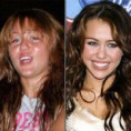 /album/galeria-de-fotos/antes-depois-miley-jpg/