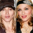 /album/galeria-de-fotos/antes-depois-madonna-jpg/