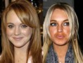 /album/galeria-de-fotos/antes-depois-lindsay-jpg/